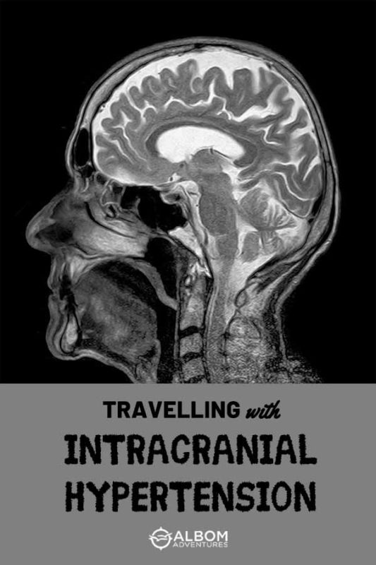 My IIH Story Includes Surgery, Leaking CSF, and Flying 9 MRI side view of a human head